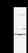 Detection of NEIL2 by Western blot. Samples: Whole cell lysate from human HeLa (H, 25 ug) , mouse NIH3T3 (M, 25 ug) and rat F2408 (R, 25 ug) cells. Predicted molecular weight: 36 kDa