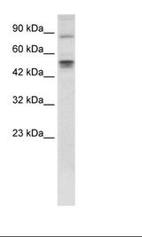 Fetal Thymus Lysate.