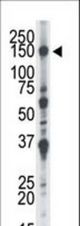 The anti-NEK1 antibody is used in Western blot to detect NEK1 in CHO cell lysate.