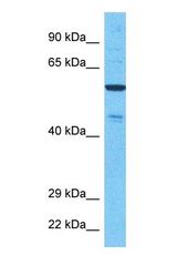 Western blot of NEK11 Antibody with human 721_B Whole Cell lysate.