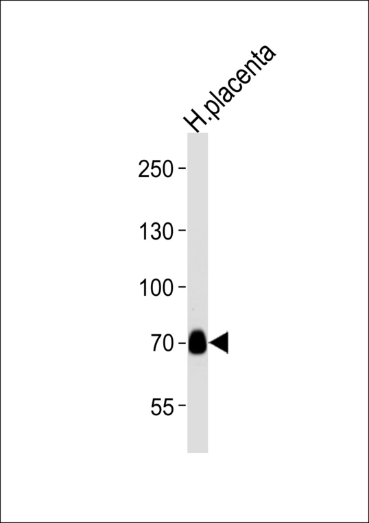 Western blot of lysate from human placenta tissue lysate, using NEK11L Antibody. Antibody was diluted at 1:1000 at each lane. A goat anti-rabbit IgG H&L (HRP) at 1:5000 dilution was used as the secondary antibody. Lysate at 35ug per lane.