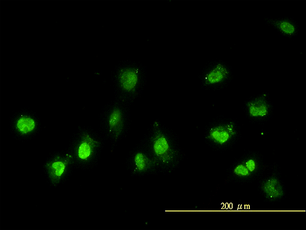 Immunofluorescence of monoclonal antibody to NEK11 on HeLa cell. [antibody concentration 10 ug/ml]