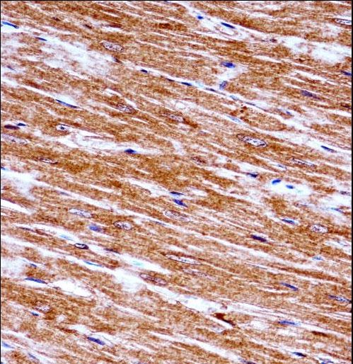Mouse Nek6 Antibody immunohistochemistry of formalin-fixed and paraffin-embedded mouse heart tissue followed by peroxidase-conjugated secondary antibody and DAB staining.