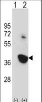 Western blot of Nek6 (arrow) using rabbit polyclonal Mouse Nek6 Antibody. 293 cell lysates (2 ug/lane) either nontransfected (Lane 1) or transiently transfected (Lane 2) with the Nek6 gene.
