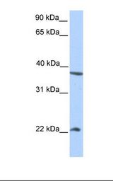 HepG2 cell lysate. Antibody concentration: 1.0 ug/ml. Gel concentration: 12%.