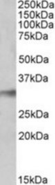 NEK7 antibody (0.1 ug/ml) staining of Human Lung lysate (35 ug protein/ml in RIPA buffer). Primary incubation was 1 hour. Detected by chemiluminescence.