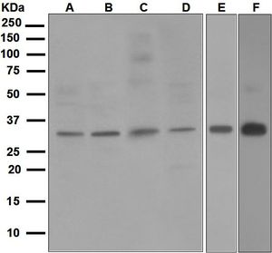 Western blot analysis on (A) human brain, (B) HeLa, (C) A549, (D) HepG2, (E) fetal liver, and (F) Jurkat lysates using anti-NEK7 antibody.