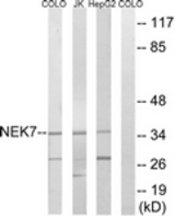 Western blot of extracts from HepG2/Jurkat/COLO cells, using NEK7 Antibody. The lane on the right was incubated with synthetic peptide.