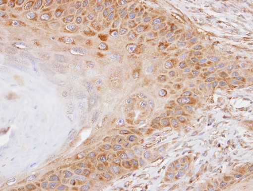 IHC of paraffin-embedded Tw2.6 xenograft using NEK7 antibody at 1:100 dilution.