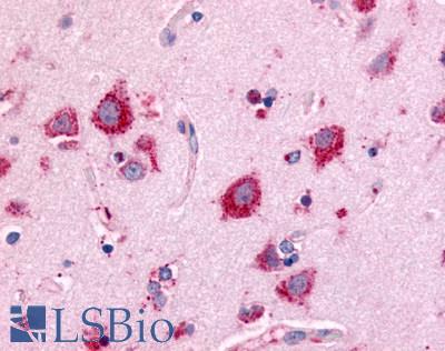 Anti-NEK7 antibody LS-A7164 IHC of human brain, neurons and glia. Immunohistochemistry of formalin-fixed, paraffin-embedded tissue after heat-induced antigen retrieval.