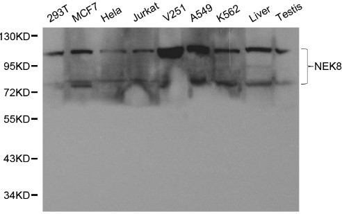 Western blot of NEK8 pAb in extracts from 293T, MCF7, Hela, Jurkat, V251, A549, K562 cells and mouse liver,testis tissues.