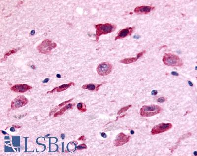 Anti-NEK9 antibody LS-A7175 IHC of human brain. Immunohistochemistry of formalin-fixed, paraffin-embedded tissue after heat-induced antigen retrieval.
