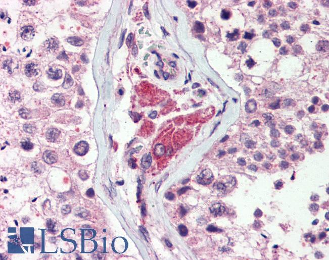 Anti-NEK9 antibody LS-A7968 IHC of human testis. Immunohistochemistry of formalin-fixed, paraffin-embedded tissue after heat-induced antigen retrieval.