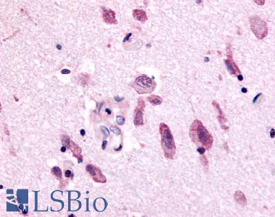 Anti-NEK9 antibody LS-A7967 IHC of human brain. Immunohistochemistry of formalin-fixed, paraffin-embedded tissue after heat-induced antigen retrieval.