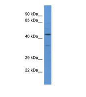 Western blot of Human PANC1. WHSC2 antibody dilution 1.0 ug/ml.