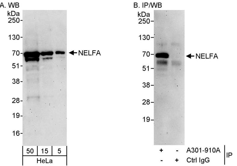 Detection of Human NELFA by Western Blot and Immunoprecipitation. Samples: Whole cell lysate (5, 15 and 50 ug for WB; 1 mg for IP, 20% of IP loaded) from HeLa cells. Antibodies: Affinity purified rabbit anti-NELFA antibody used for WB at 0.1 ug/ml (A) and 1 ug/ml (B) and used for IP at 3 ug/mg lysate. Detection: Chemiluminescence with exposure times of 3 minutes (A and B).