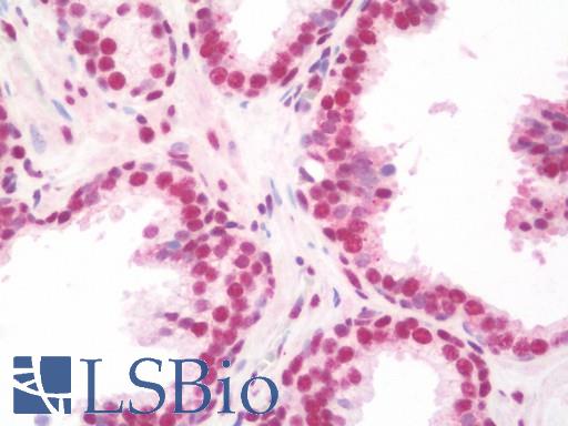 Anti-NELFA / WHSC2 antibody IHC staining of human prostate. Immunohistochemistry of formalin-fixed, paraffin-embedded tissue after heat-induced antigen retrieval. Antibody LS-B10744 concentration 10 ug/ml.