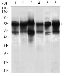 Western blot using WHSC2 mouse monoclonal antibody against Jurkat (1), HeLa (2), HEK293 (3), A549 (5), SPC-A-1 (6) cell lysate, and Rat brain (4) tissue lysate.