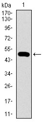 Western blot using WHSC2 monoclonal antibody against human WHSC2 recombinant protein. (Expected MW is 50.2 kDa)