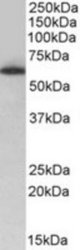 TH1L antibody (0.5 ug/ml) staining of nuclear Jurkat lysate (35 ug protein/ml in RIPA buffer). Primary incubation was 1 hour. Detected by chemiluminescence.