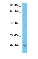 Western blot of NELFD Antibody with human MCF7 Whole Cell lysate.