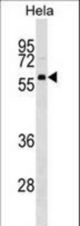 TH1L Antibody western blot of HeLa cell line lysates (35 ug/lane). The TH1L antibody detected the TH1L protein (arrow).