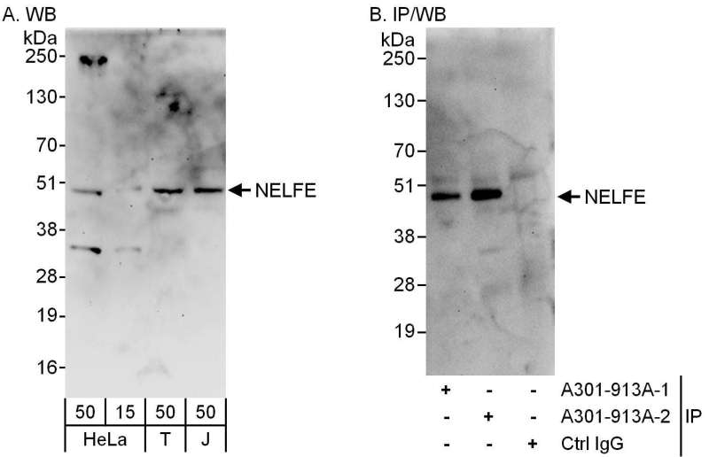 Detection of Human NELFE by Western Blot and Immunoprecipitation. Samples: Whole cell lysate from HeLa (15 and 50 ug for WB; 1 mg for IP, 20% of IP loaded), 293T (T; 50 ug) and Jurkat (J; 50 ug) cells. Antibodies: Affinity purified rabbit anti-NELFE antibody used for WB at 0.4 ug/ml (A) and 1 ug/ml (B) and used for IP at 6 ug/mg lysate. NELFE was also immunoprecipitated by a previous lot of this antibody. Detection: Chemiluminescence with exposure times of 3 minutes (A) and 30 seconds (B).