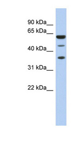 RDBP antibody LS-C110517 Western blot of Fetal Spleen lysate.