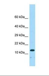 Western blot of Human Fetal Heart. NENF antibody dilution 1.0 ug/ml.