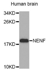 Western blot blot of extracts of Human brain cell line, using NENF antibody.