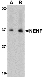 Western blot of NENF in human kidney tissue lysate with NENF antibody at (A) 1 and (B) 2 ug/ml.