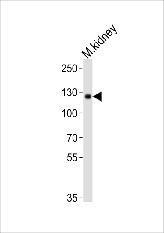 Western blot of lysate from mouse kidney tissue lysate with Mouse Ddr1 Antibody. Antibody was diluted at 1:1000. A goat anti-rabbit IgG H&L (HRP) at 1:10000 dilution was used as the secondary antibody. Lysate at 20 ug.