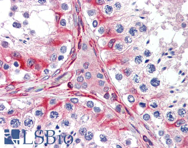 Anti-DDR1 antibody IHC of human testis. Immunohistochemistry of formalin-fixed, paraffin-embedded tissue after heat-induced antigen retrieval. Antibody LS-B3861 dilution 1:200.