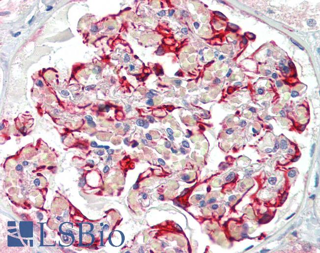 Anti-DDR1 antibody IHC of human kidney. Immunohistochemistry of formalin-fixed, paraffin-embedded tissue after heat-induced antigen retrieval. Antibody LS-B3861 dilution 1:200.