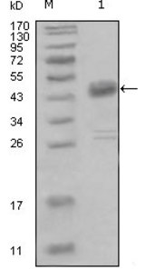 Western blot using DDR1 mouse monoclonal antibody against truncated MBP-DDR1 recombinant protein (1).