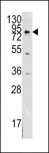 Western blot of anti-MCK10 antibody in SK-BR-3 cell line lysates (35 ug/lane). MCK10 (arrow) was detected using the purified antibody.