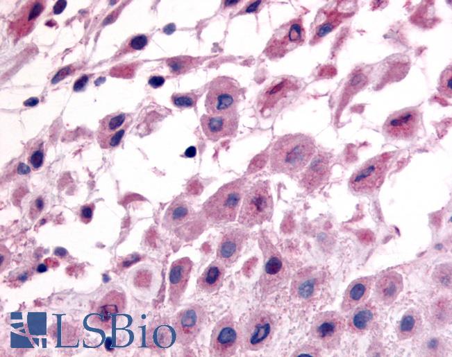 Anti-DDR1 antibody LS-A2853 IHC of human placenta. Immunohistochemistry of formalin-fixed, paraffin-embedded tissue after heat-induced antigen retrieval.