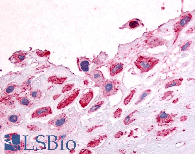 Anti-DDR1 antibody LS-A3436 IHC of human decidual cells. Immunohistochemistry of formalin-fixed, paraffin-embedded tissue after heat-induced antigen retrieval.