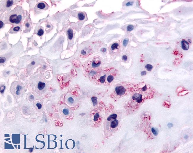 Anti-DDR1 antibody LS-A2854 IHC of human decidual cells. Immunohistochemistry of formalin-fixed, paraffin-embedded tissue after heat-induced antigen retrieval.