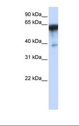 HepG2 cell lysate. Antibody concentration: 1.0 ug/ml. Gel concentration: 12%.