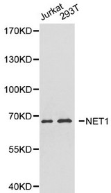 Western blot of NET1 pAb in extracts from Jurkat and 293T cells.