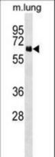 NET1 Antibody western blot of mouse lung tissue lysates (35 ug/lane). The NET1 antibody detected the NET1 protein (arrow).