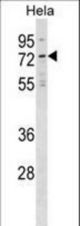 NET1 Antibody western blot of HeLa cell line lysates (35 ug/lane). The NET1 antibody detected the NET1 protein (arrow).
