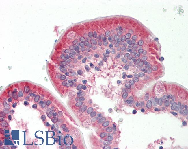 Human Small Intestine: Formalin-Fixed, Paraffin-Embedded (FFPE)