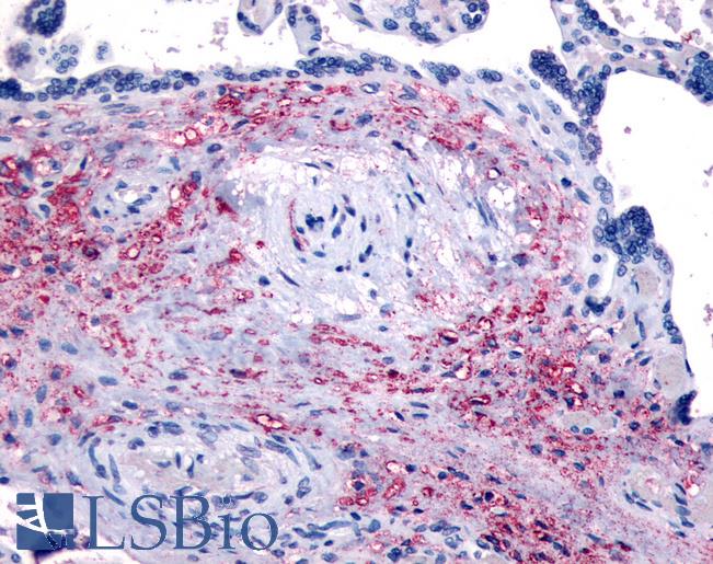 Anti-NET1 antibody LS-A3409 IHC of human placenta. Immunohistochemistry of formalin-fixed, paraffin-embedded tissue after heat-induced antigen retrieval.