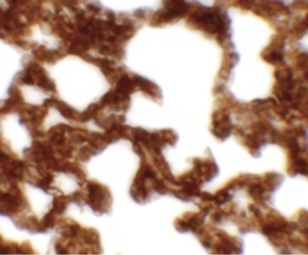 Immunohistochemistry of NETO1 in rat lung tissue with NETO1 antibody at 2.5 ug/ml.