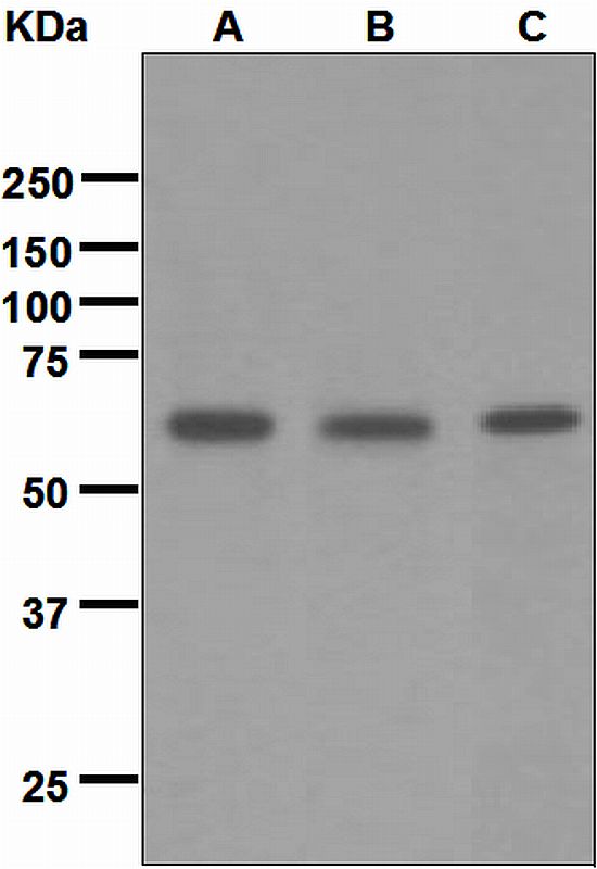 Western blot analysis on (A) human cerebellum, (B) SH-SY5Y, and (C) human brain lysates using anti-NETO2 antibody.