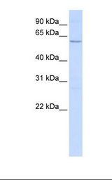 721_B cell lysate. Antibody concentration: 1.0 ug/ml. Gel concentration: 12%.