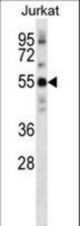NETO2 Antibody (N-term ) western blot of Jurkat cell line lysates (35 ug/lane). The NETO2 antibody detected the NETO2 protein (arrow).