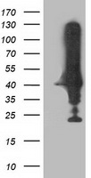 HEK293T cells were transfected with the pCMV6-ENTRY control (Left lane) or pCMV6-ENTRY NEU2 (Right lane) cDNA for 48 hrs and lysed. Equivalent amounts of cell lysates (5 ug per lane) were separated by SDS-PAGE and immunoblotted with anti-NEU2.